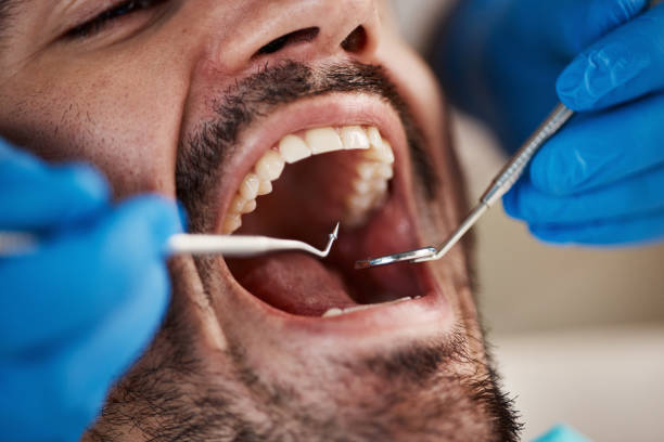 Best Emergency Denture Repair in Vass, NC